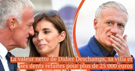 Les 36 ans de Didier Deschamps avec Claude - valeur nette, villa de 3 millions d'euros et dents refaites pour plus de 25 000 euros
